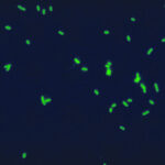 bakteria Legionella Pneumophila